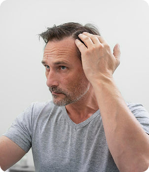 Hair Loss